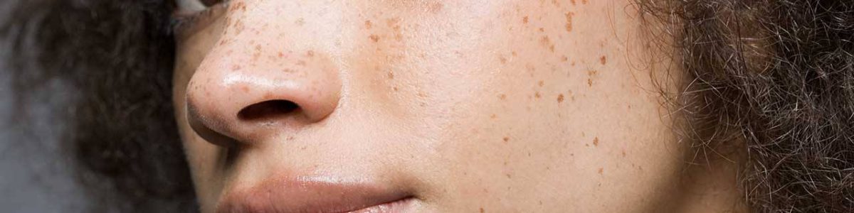 How to match your make-up with your freckles