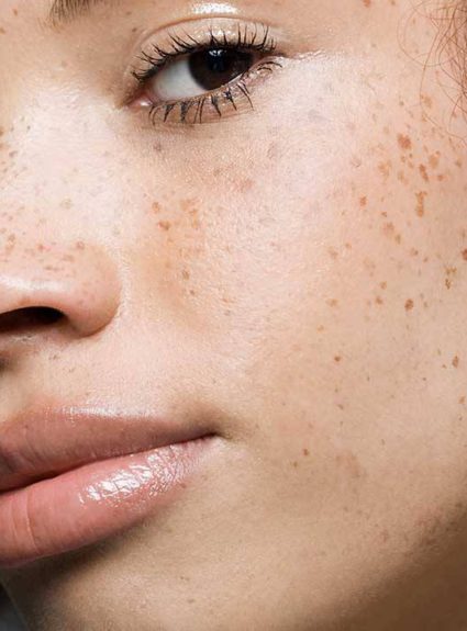 How to match your make-up with your freckles