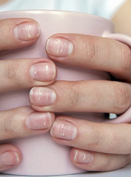 White Spots on nails
