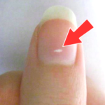 White Spots on nails - Rambling Rose